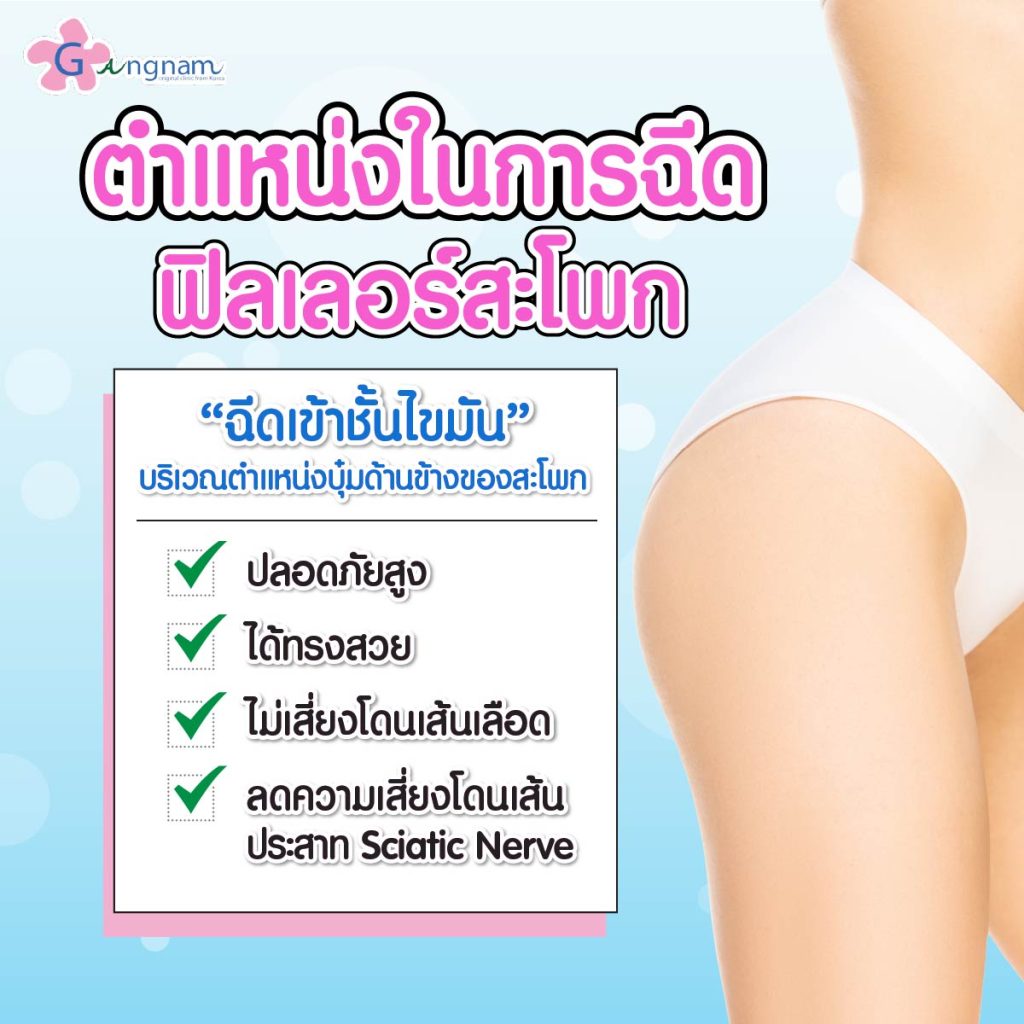 ตำแหน่งในการฉีด
