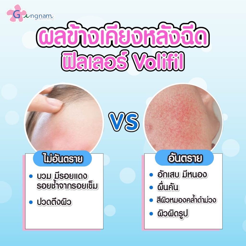 ผลข้างเคียงหลังฉีด