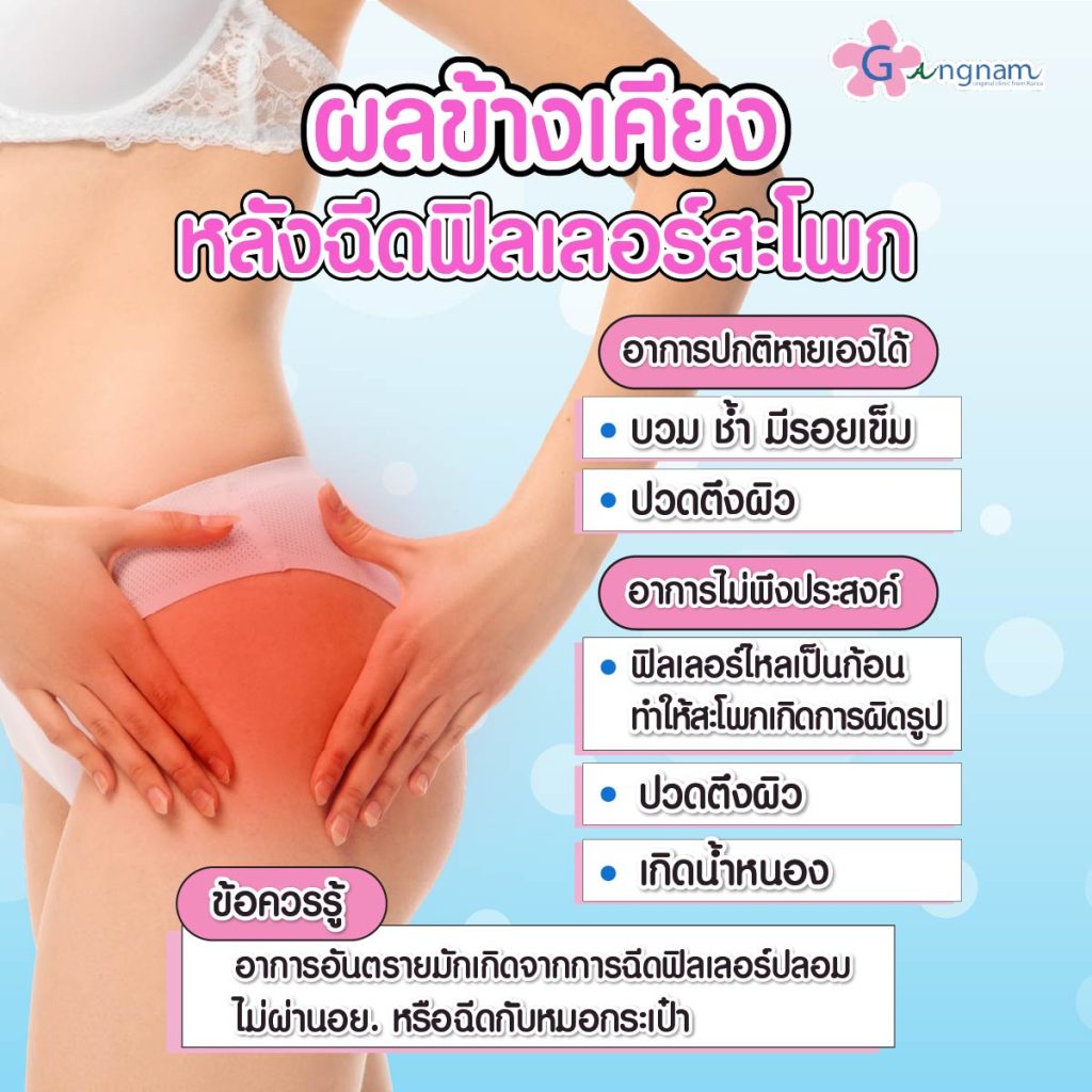 ผลข้างเคียงหลังฉีดฟิลเลอร์สะโพก