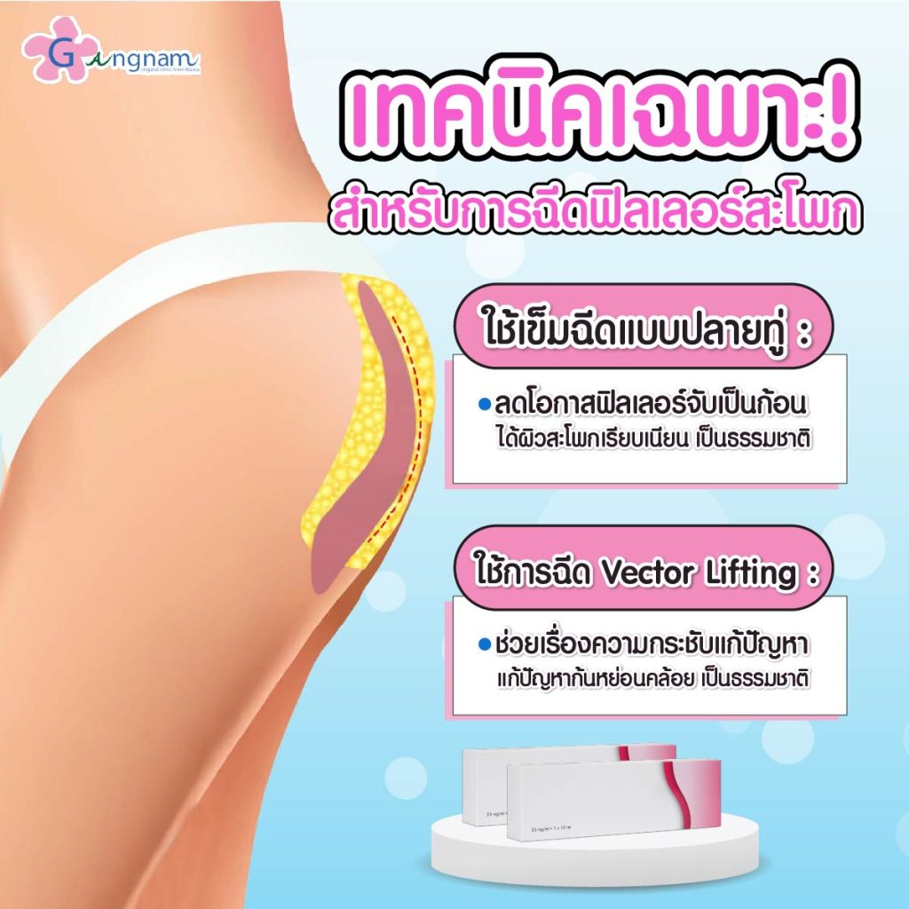 เทคนิคการฉีด