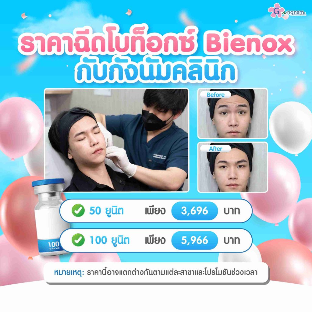 ราคาค่าฉีดbienox โบท็อกซ์